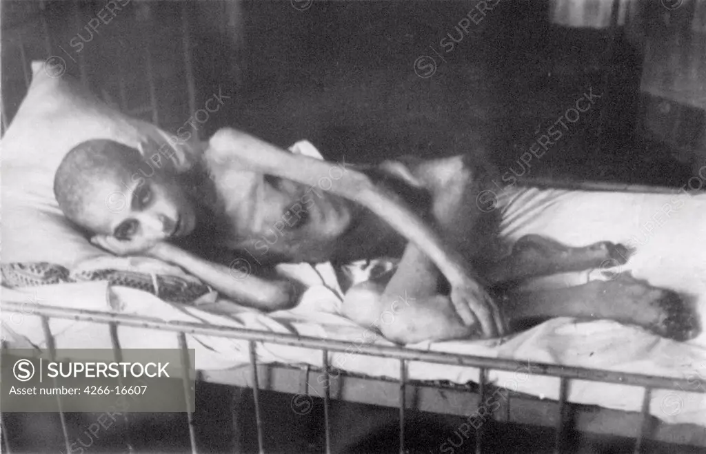 Girl victim of  dystrophy by Anonymous  /Museum of the Siege of Leningrad, St. Petersburg/1944-1945/Photograph/Russia/History