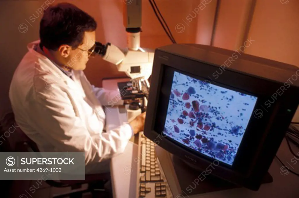 Microscopic examination of a cervical smear Screening of cervical cancer and STD