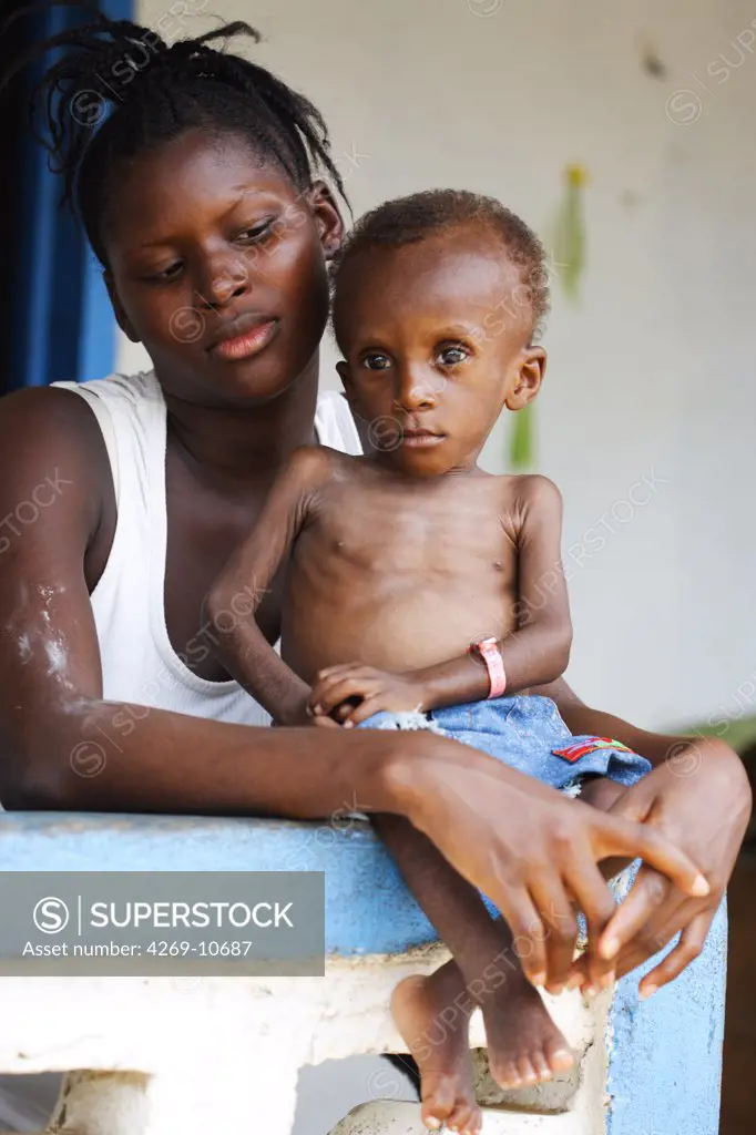18 months old undernourished child suffering from marasmus with his mother in a Therapeutic Feeding Center in Monrovia, Liberia, implemented by Action contre la Faim (ACF), an international non-governmental organisation (Action against Hunger).