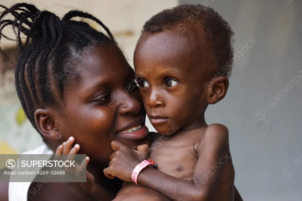 18 months old undernourished child suffering from marasmus with his mother in a Therapeutic Feeding Center in Monrovia, Liberia, implemented by Action contre la Faim (ACF), an international non-governmental organisation (Action against Hunger).