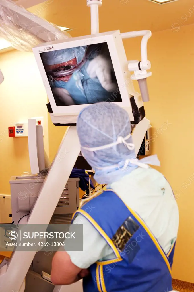 Patient with degenerative arthosis receiving intervertebral disk prosthesis to treat herniated cervical disc. This cervical rachis surgery is performed with the O-ARM Imaging System. This motorized intra-operative multi-dimensional surgical imaging platform provides real-time high resolution fluoroscopy and 3D CT scan imaging, and allows high precision and safety surgical procedures. Surgery performed by Pr Jean-Jacques Moreau, neurosurgery department, Dupuytren hospital, Limoges, France.