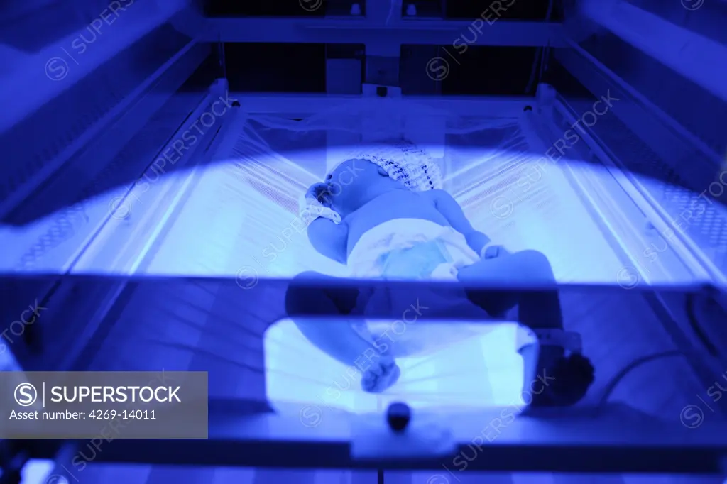 Newborn baby undergoing ultraviolet light treatment for jaundice.