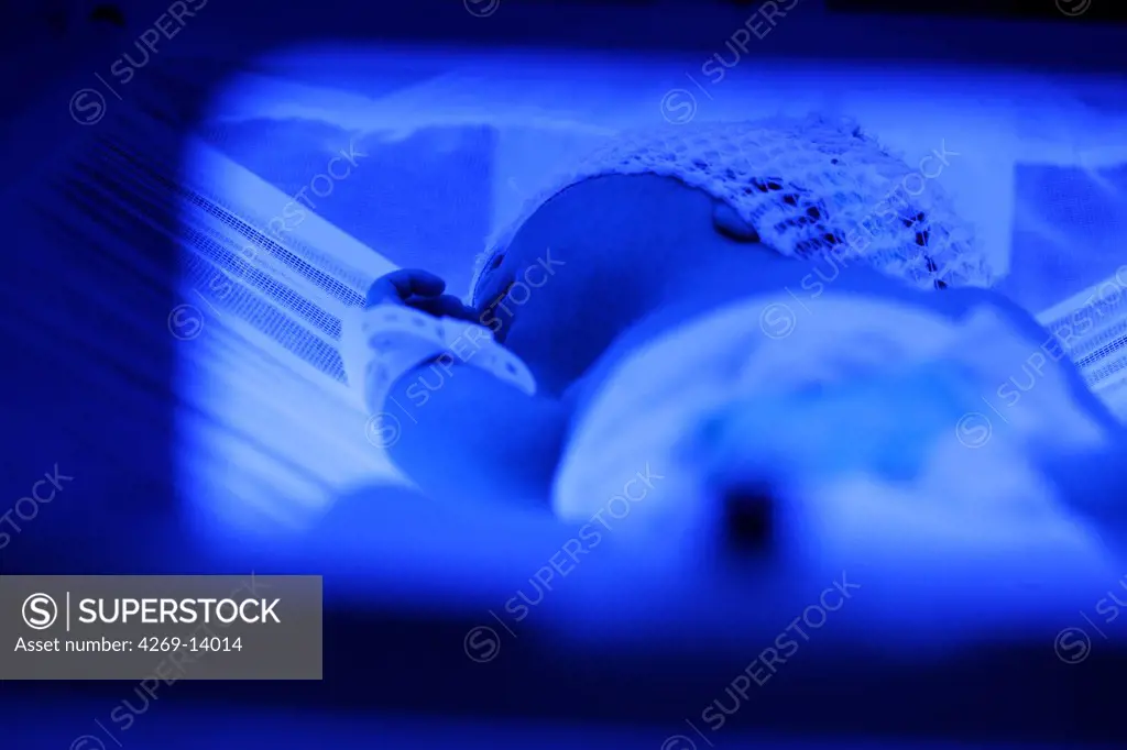 Newborn baby undergoing ultraviolet light treatment for jaundice.