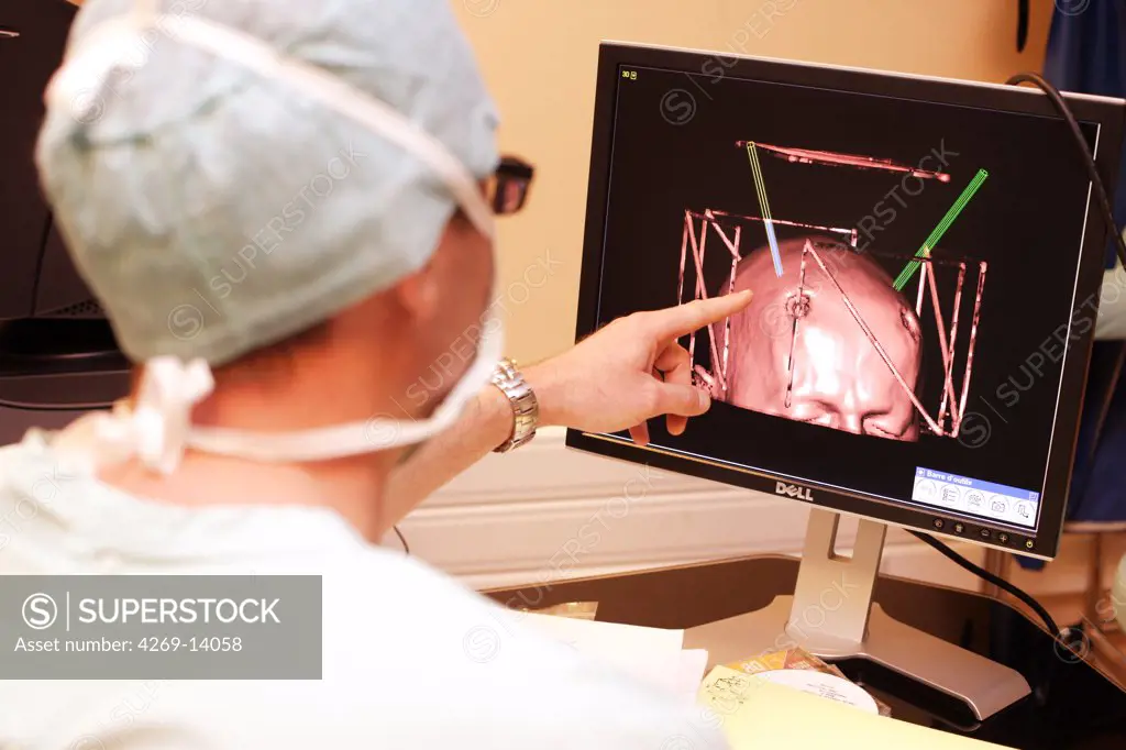 A patient with Parkinson's disease is treated with thalamic stimulation : electrods are inserted into the brain and fed with a thalamic pacemaker implanted in the thorax. This neurosurgery is performed with the O-ARM Imaging System. This motorized intra-operative multi-dimensional surgical imaging platform provides real-time high resolution fluoroscopy and 3D CT scan imaging, and allows high precision and safety surgical procedures. Here, the implantation of the electrods is 3D simulated and the