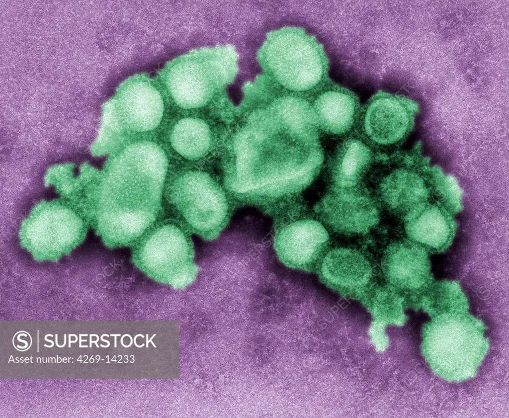 Transmission Electron Micrograph (TEM) of the swine flu virus. The Swine flu virus is a strain H1N1 of influenza type A virus (orthomyxovirus) causing respiratory diseases to swines. Further to mutations and recombinaison with other influenza type A viruses (like avaian or human influenza), new strains transmissible from animals to humans and pathogenic to them can be created.