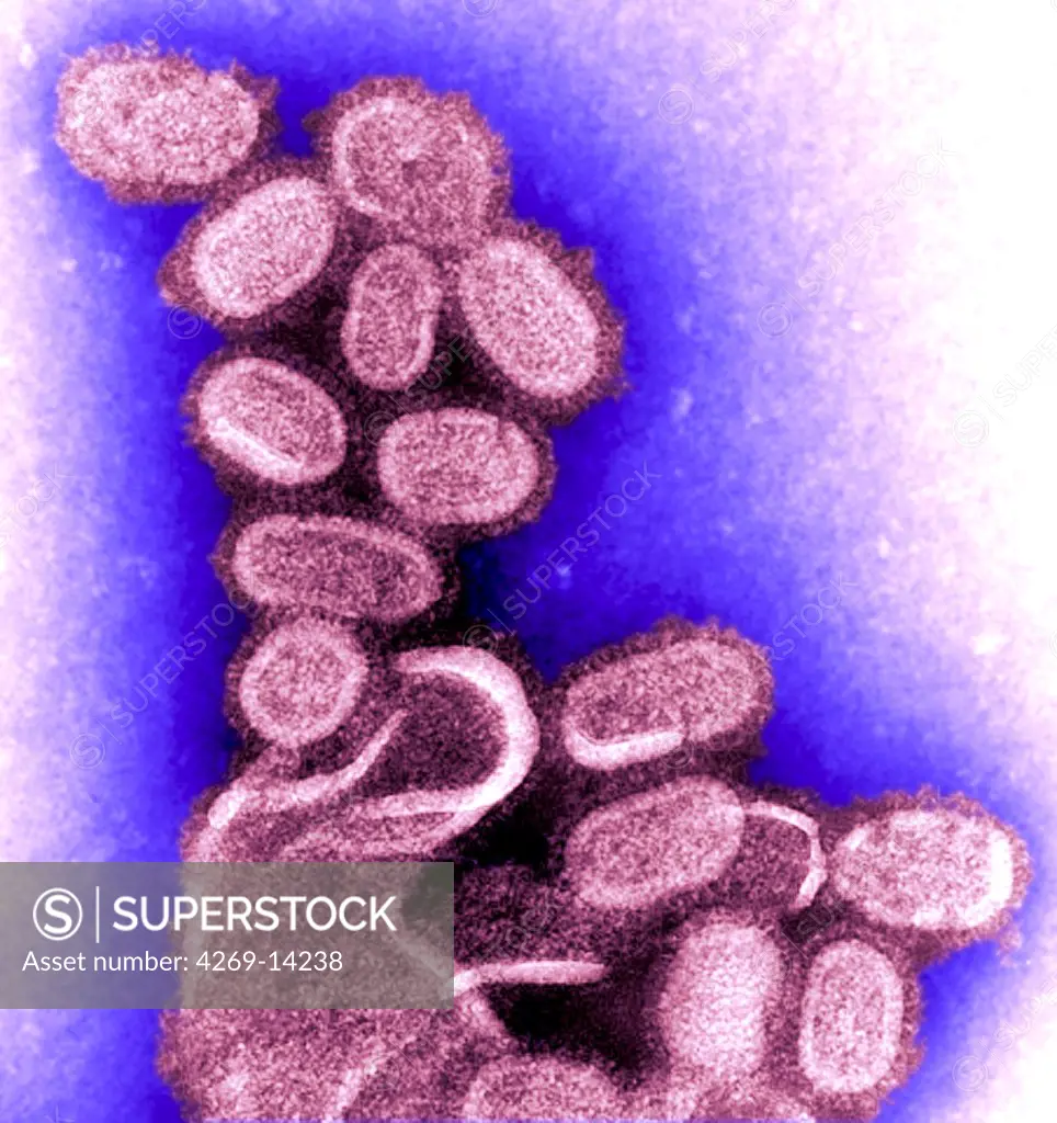 Transmission Electron Micrograph (TEM) of Spanish flu virus. This pandemic virus infected a fifth of the world population and killed between 20 and 50 million. This Influenza virus type a, strain H1N1 is very close to the swine flu (strain H1N1) and the avian flu virus (strain H5N1).