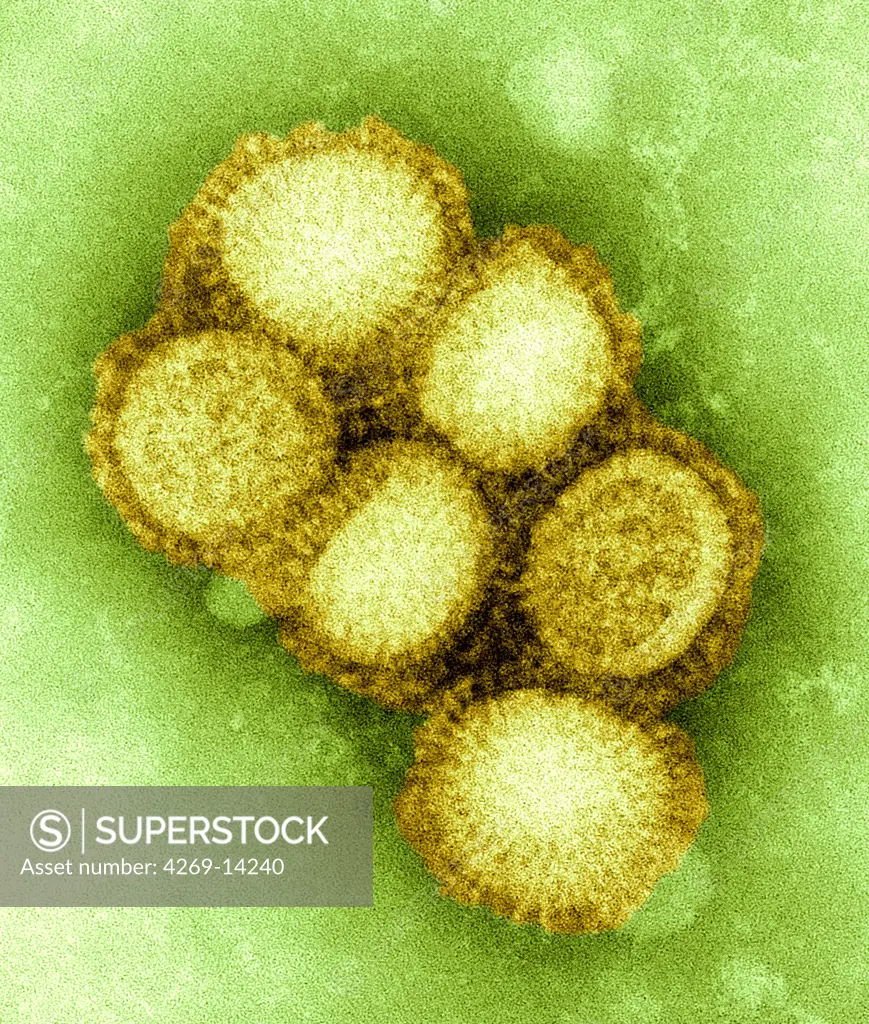 2009 C. S. Goldsmith and A. Balish This preliminary negative stained transmission electron micrograph (TEM) depicted some of the ultrastructural morphology of the A/CA/4/09 swine flu virus.  What is Swine Influenza   Swine Influenza (swine flu) is a respiratory disease of pigs caused by type A influenza virus that regularly causes outbreaks of influenza in pigs. Swine flu viruses cause high levels of illness and low death rates in pigs. Swine influenza viruses may circulate among sw