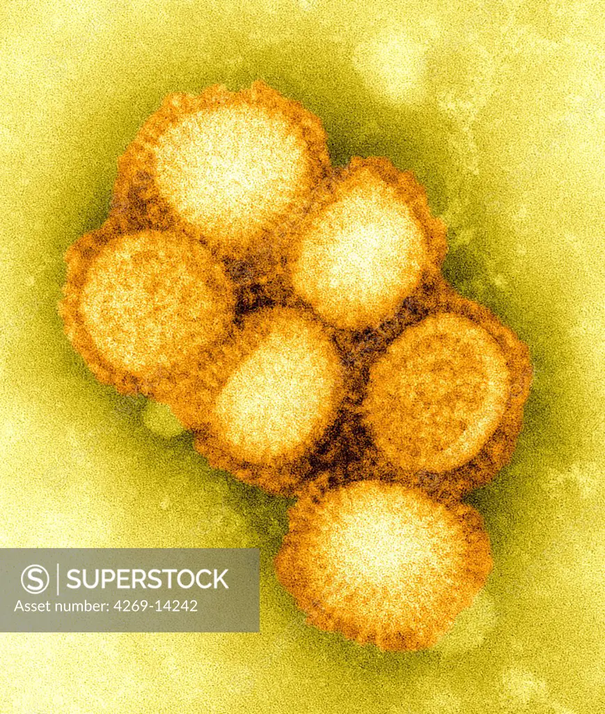 2009 C. S. Goldsmith and A. Balish This preliminary negative stained transmission electron micrograph (TEM) depicted some of the ultrastructural morphology of the A/CA/4/09 swine flu virus.  What is Swine Influenza   Swine Influenza (swine flu) is a respiratory disease of pigs caused by type A influenza virus that regularly causes outbreaks of influenza in pigs. Swine flu viruses cause high levels of illness and low death rates in pigs. Swine influenza viruses may circulate among sw