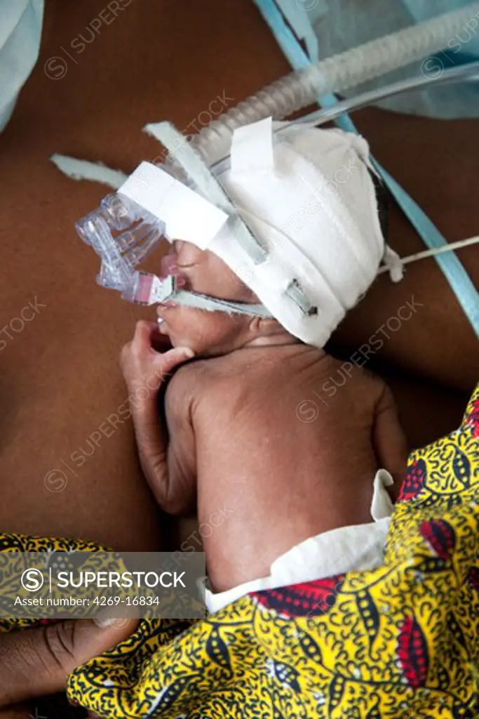 Premature newborn baby placed under respiratory assistance. Neonatalogy department, Robert Debré hospital, Paris, France.