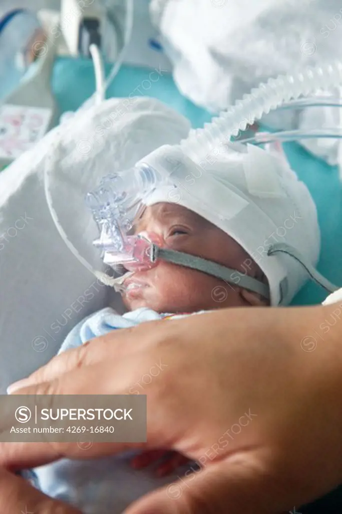 Premature newborn baby placed under respiratory assistance, mother putting her hands over her baby to quiet. Neonatalogy department, Robert Debré hospital, Paris, France.