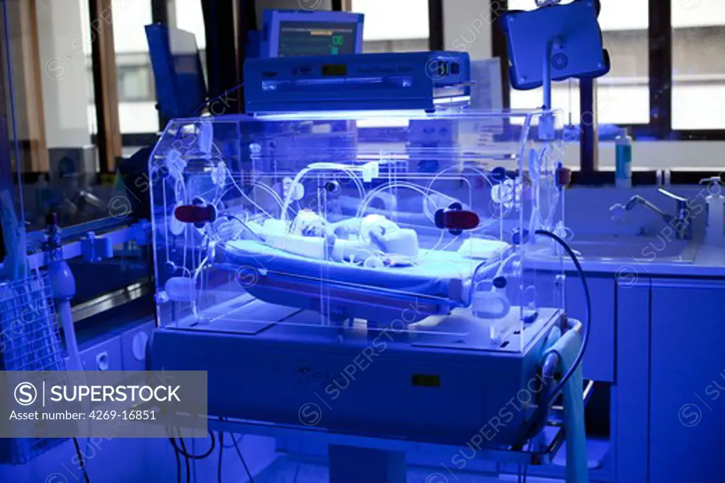 Newborn baby undergoing ultraviolet light treatment for jaundice. Neonatalogy department, Robert Debré hospital, Paris, France.