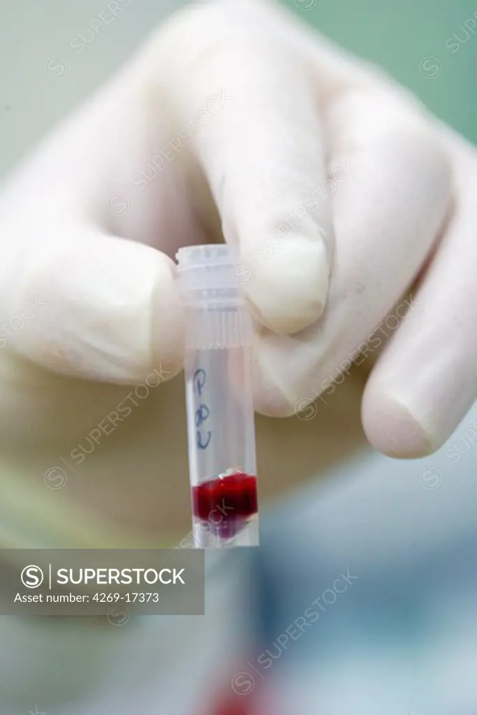 Blood samples used for oncognetic analysis. Human Molecular Oncology laboratory of Oscar Lambret cancerology center, Lille, France.