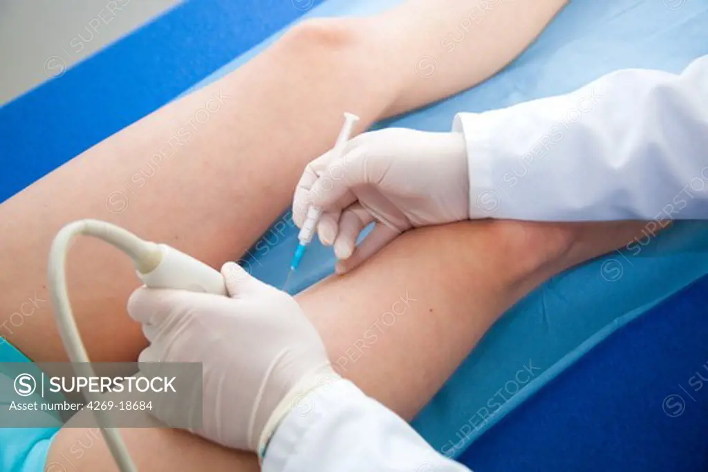 Treatment of varicose veins by injection of foam thanks to doppler ultrasound navigation.