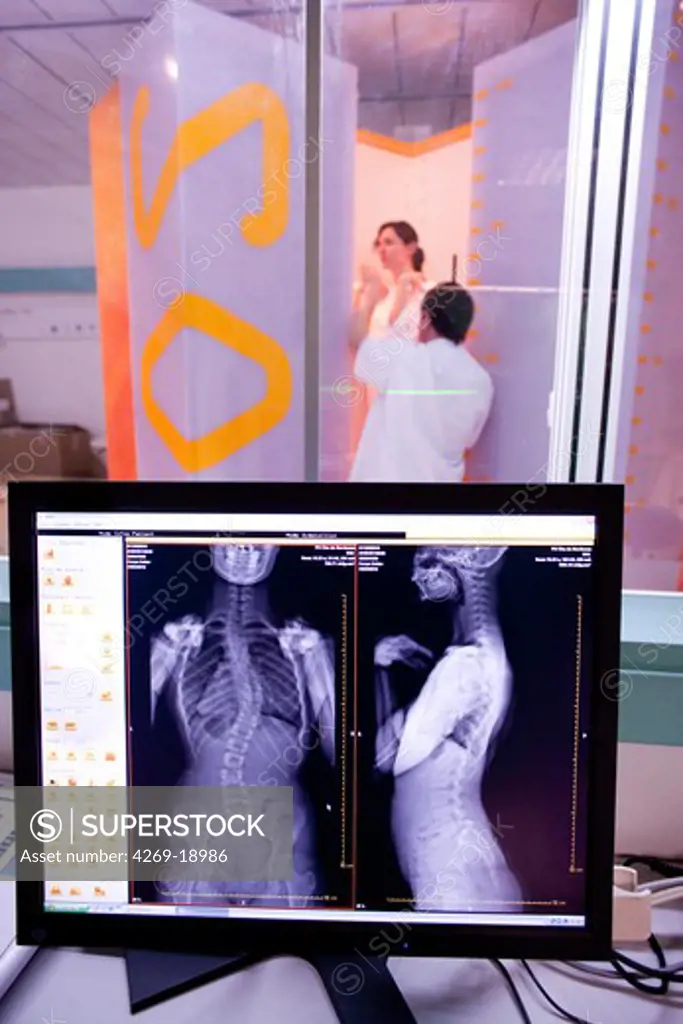This 2D and 3D digital X-ray imaging equipment is dedicated to the orthopedic practice and permits a static study of the musculoskeletal system. It takes by low dose X-ray scanning two simultaneous, perpendicular planar views in the standing position. A reconstruction provides a 2 and 3D image of the osteoarticular structures of the patient. The university hospital of Bordeaux is the first hospital to use this diagnostic technique in France.
