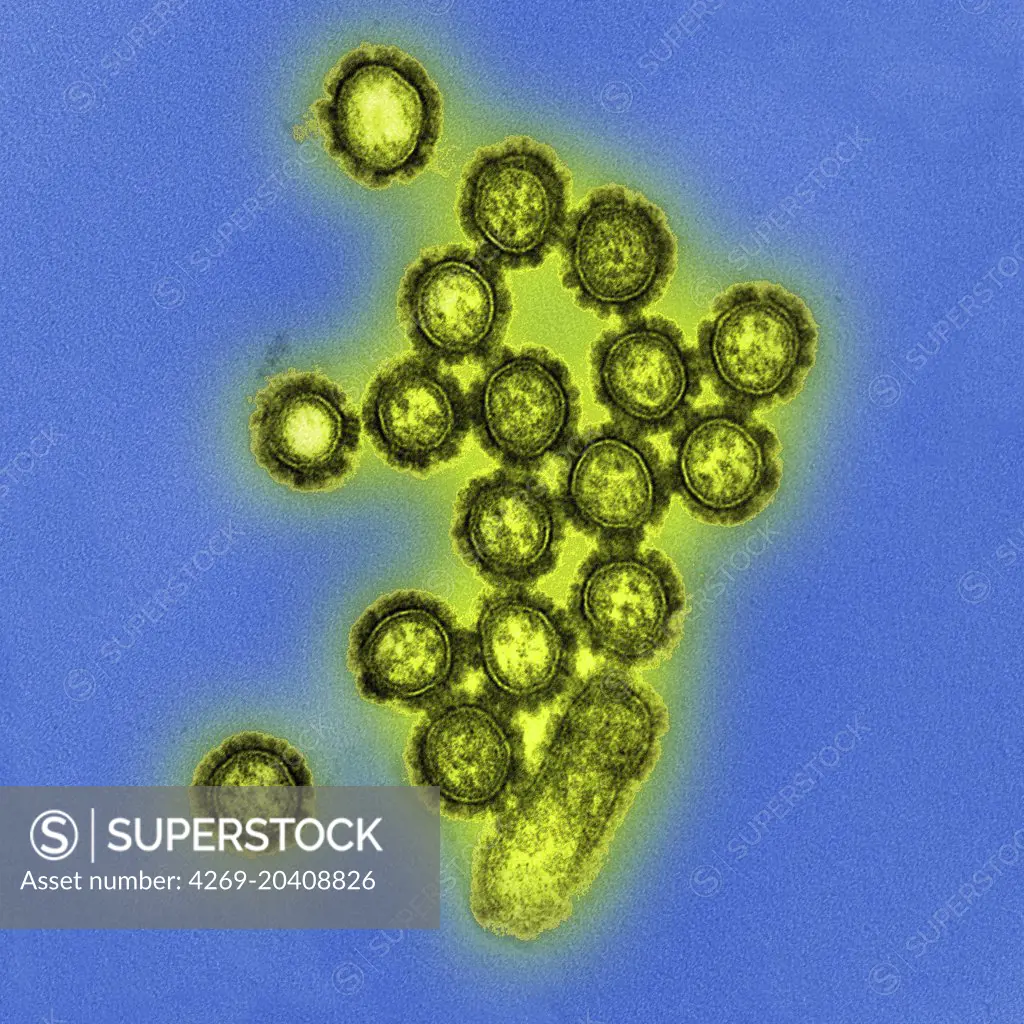 H1N1 influenza virus particle, Transmission Electron Micrograph (TEM).