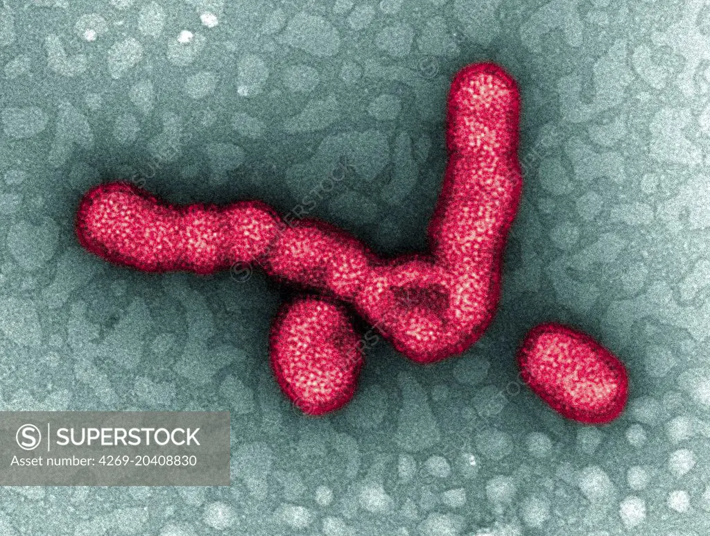 Transmission Electron Micrograph (TEM) depicts numbers of H1N1 influenza virus particles.