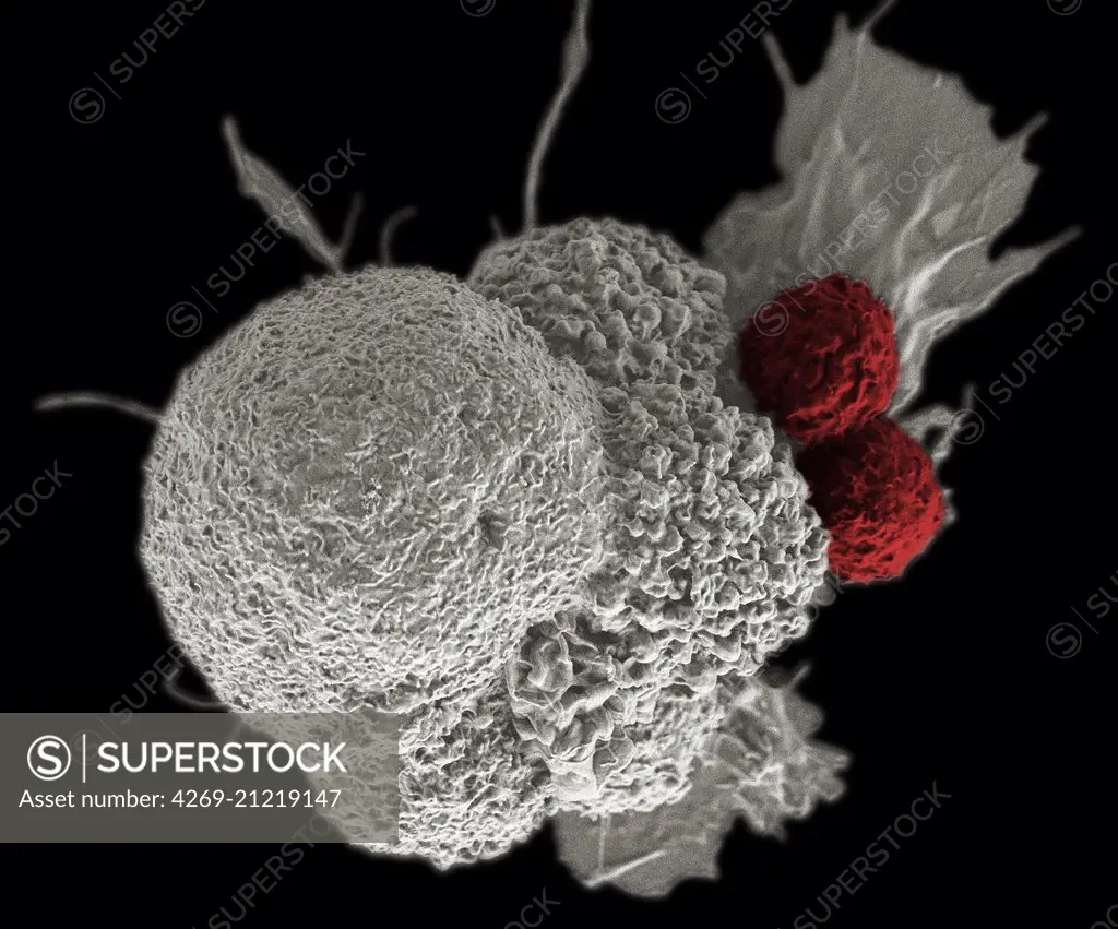T lymphocytes and cancer cell, Coloured scanning electron micrograph (SEM) .