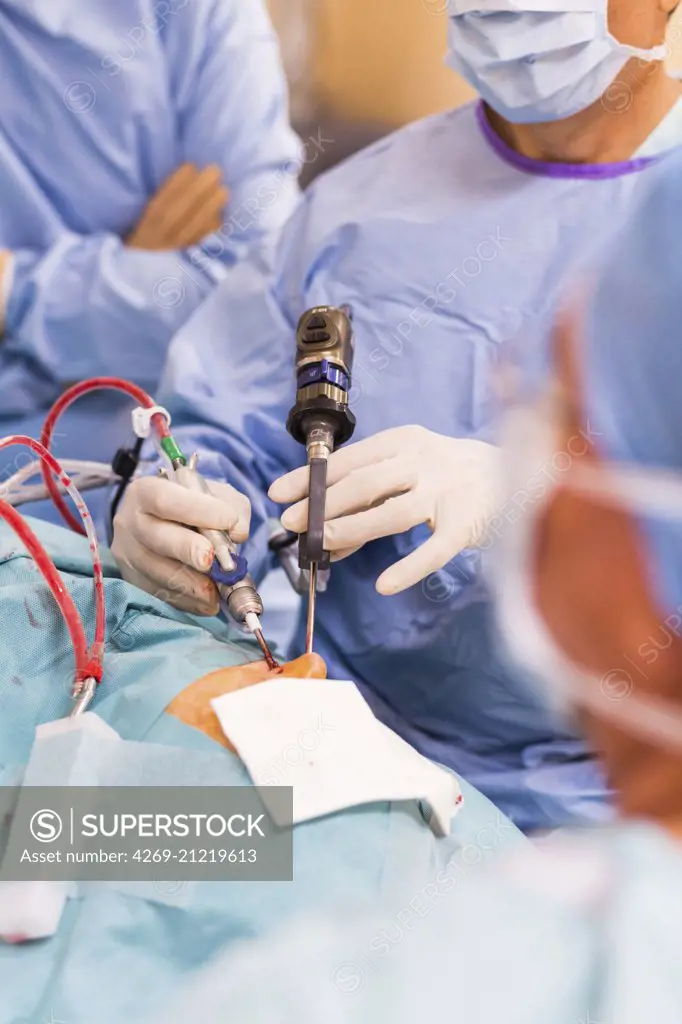 Sinus surgery, Surgeons performing functional endoscopic sinus surgery, Limoges hospital, France.