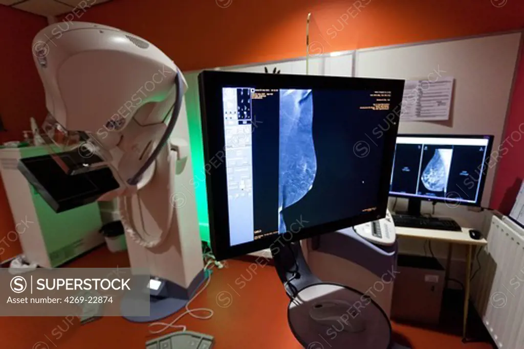 Senobright contrast-enhanced digital mammography. This new technology developed by GE Healthcare provides contrasting image to highlight potential areas of angiogenesis. Armentieres hospital, France.