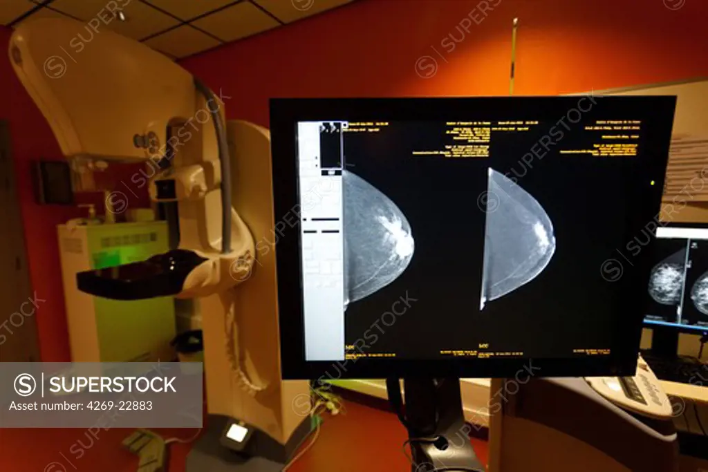 At left, a digital mammography, at right, Senobright contrast-enhanced digital mammography. This new technology developed by GE Healthcare provides contrasting image to highlight potential areas of angiogenesis. Armentieres hospital, France.