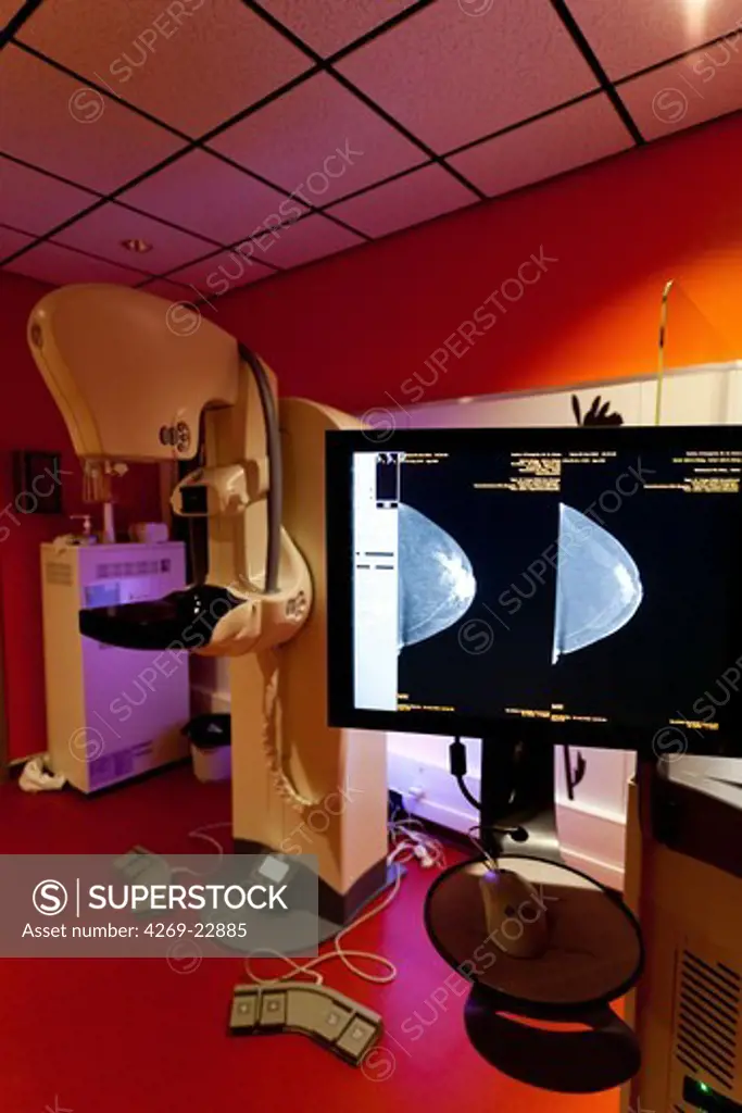 At left, a digital mammography, at right, Senobright contrast-enhanced digital mammography. This new technology developed by GE Healthcare provides contrasting image to highlight potential areas of angiogenesis. Armentieres hospital, France.