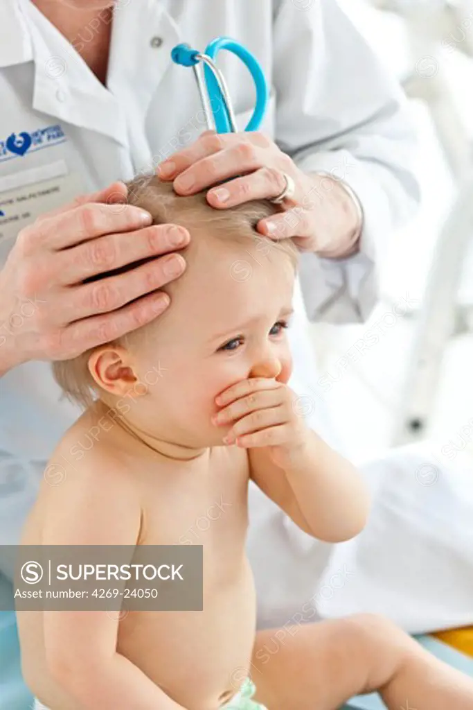 Scalp examination of 14 months old baby girl.
