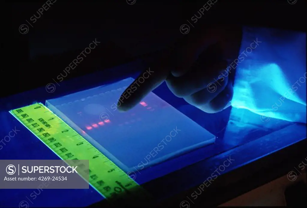 Genetics. Laboratory of Genetic researches on multifactorial diseases of Lille, France. A researcher is reading an Amplified DNA sequence gel under UV light.