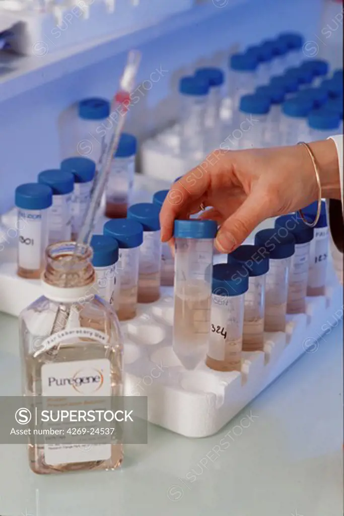 Genetics of multifactorial diseases. Laboratory of genetic research on multifactorial diseases of the Institute of Biology of Lille / CNRS (French National Center for Scientific Research, France.  Preparation of DNA samples to be purifies and stored in the DNA bank.