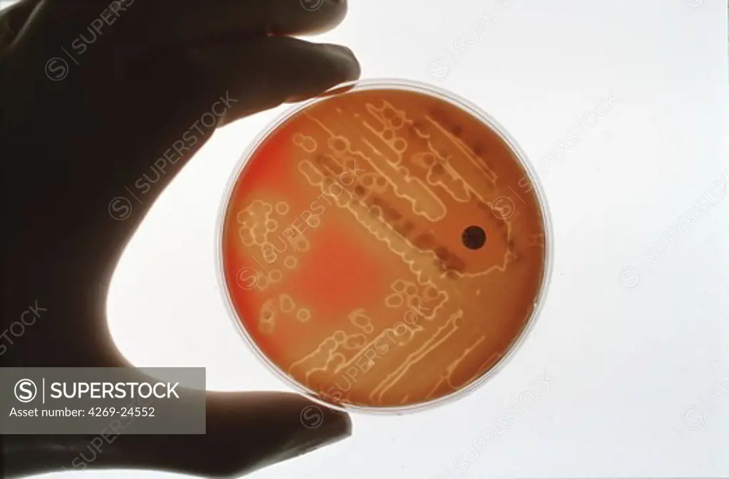 Pneumococcus. Pneumology Antibiotic sensitivity test