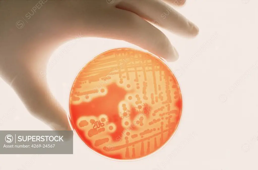 Bacteriology. Culture of Gram-positive Staphylococcus aureus in Petri dish .