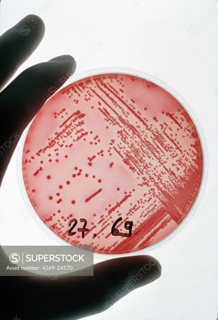 Bacteriology. UCA (Urines Cytobacteriological Analysis). Culture in Petri dish of Escherichia coli, Gram-negative bacillus bacterium found in the human digestive tract, responsible for urinary tract infections, travelers' diarrhea and gastroenteritis.
