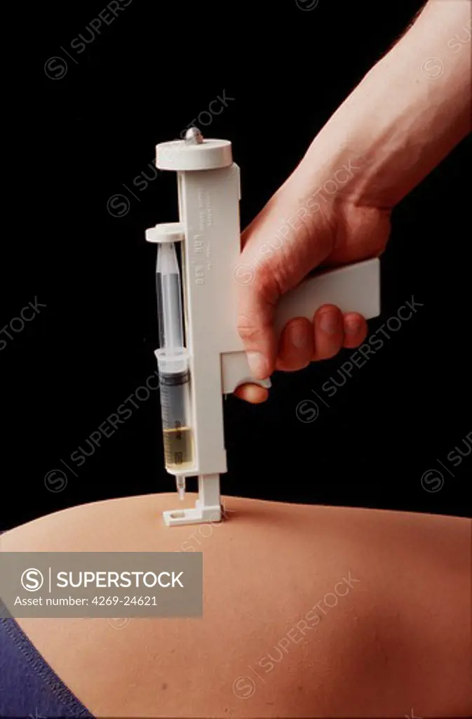 Mesotherapy. Mesotherapy consists in injecting allopathic medications in homeopathic doses locally. Here for cellulite treatment.