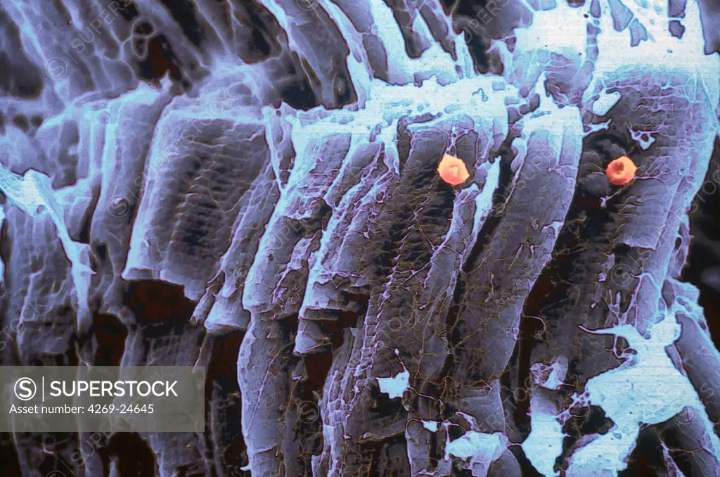 Muscle. Muscle fibre with 2 red blood cells SEM (Scanning Electron Microscope)