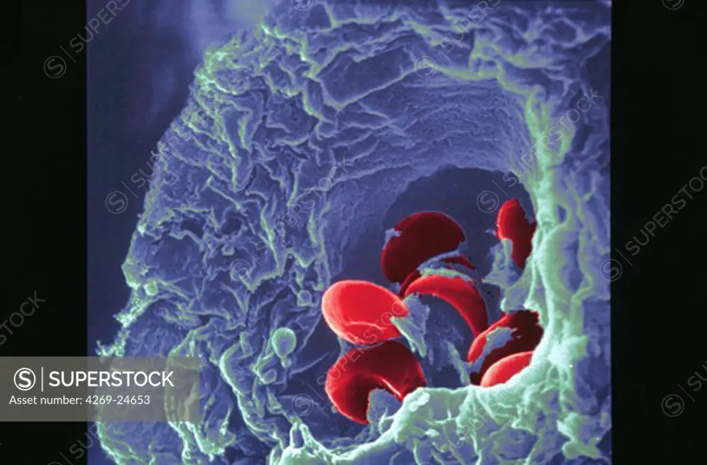 Blood vessel and red blood cells in placenta. SEM (Scanning Electron Microscope)