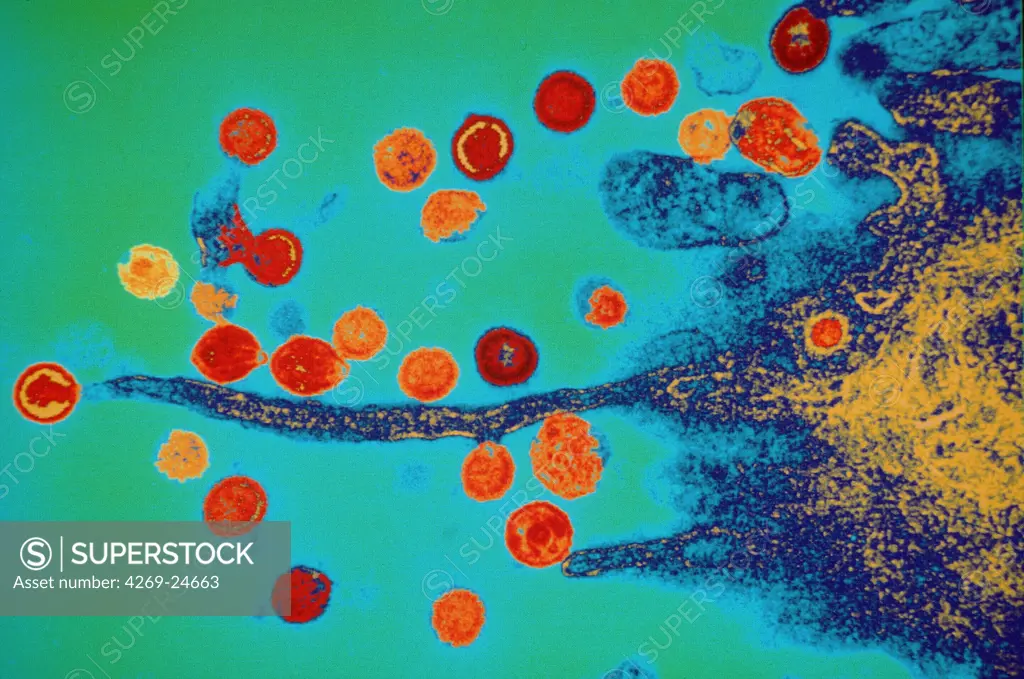 AIDS virus (VIH1). Color enhanced transmission electron micrograph (TEM) of an HIV virus budding out of an infected T-lymphocyte cell.