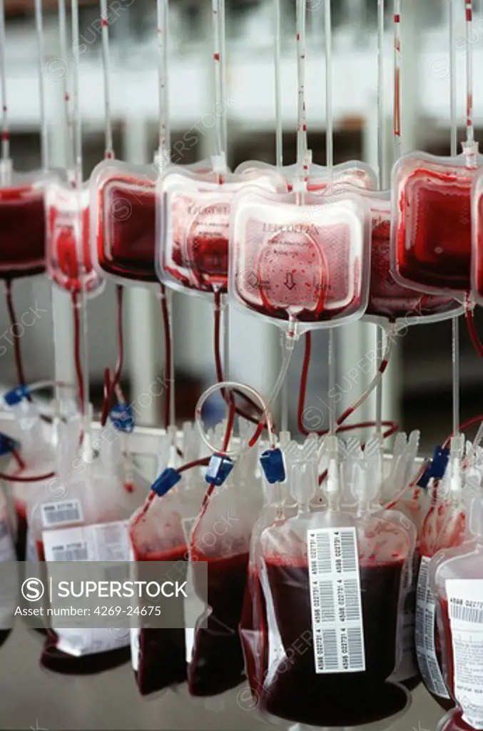 Blood transfusion. Blood filtration in a Blood transfusion center : the blood components are separated by gravity filtration to obtain different blood products.
