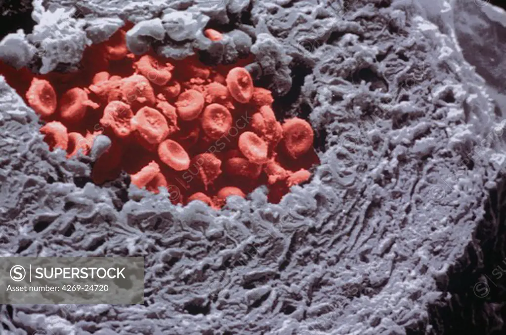 Artery. Artery section Wall (in grey) : collagen fibres and muscle cells Cnter (in red) : red blood cells