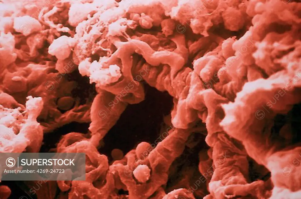Lung. Alveoli of the lungs SEM (Scanning Electron Microscope)