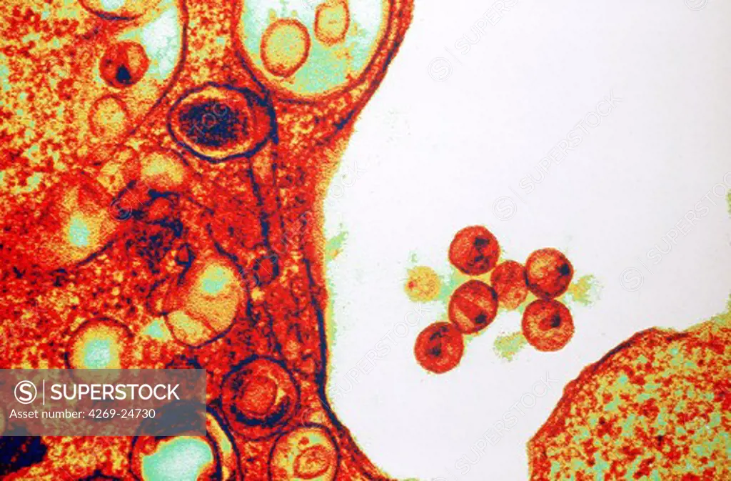 AIDS virus (VIH). Color enhanced transmission electron micrograph (TEM) of an HIV virus budding out of an infected T-lymphocyte cell.