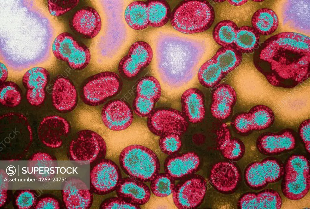 Hepatitis B virus. Color enhanced Transmission Electron Micrograph (TEM) of the Hepatitis B virus (HBV, Hepadnaviridae).