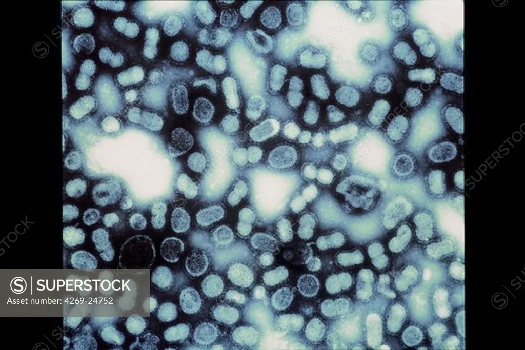 Hepatitis B virus. Color enhanced Transmission Electron Micrograph (TEM) of the Hepatitis B virus (HBV, Hepadnaviridae).