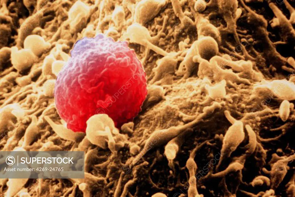 Blood cell. Lymphocyte on endothelial cells Leucocytes family (Lymphocyte) SEM (Scanning Electron Microscope)