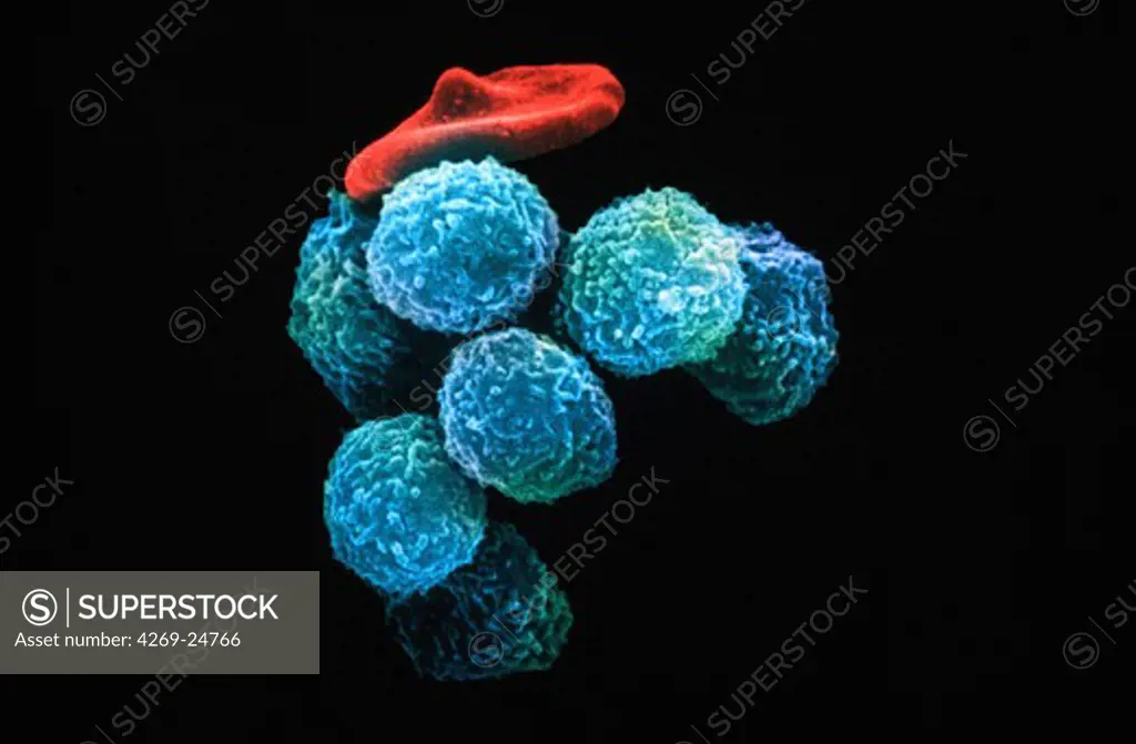 Blood cell. Lymphocytes (blue spheres) Red blood corpuscule (in red) SEM (Scanning Electron Microscope)