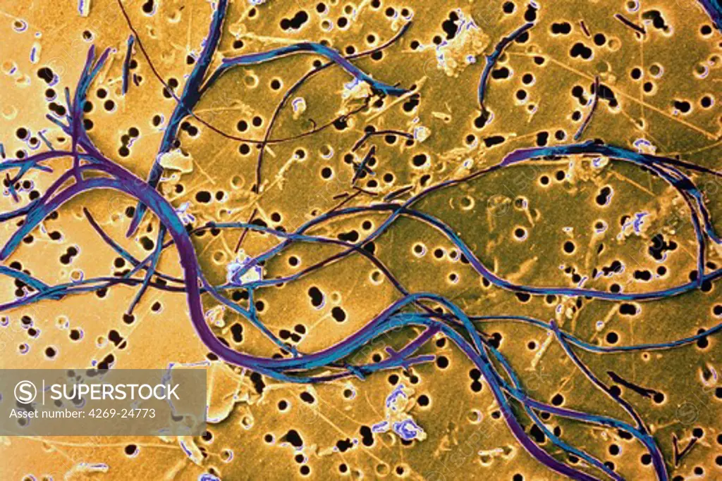 Asbestos. Asbestos fibres, responsible for lungs affections such as asbestosis ESM (Electron Scanning Microscope) (x3000)
