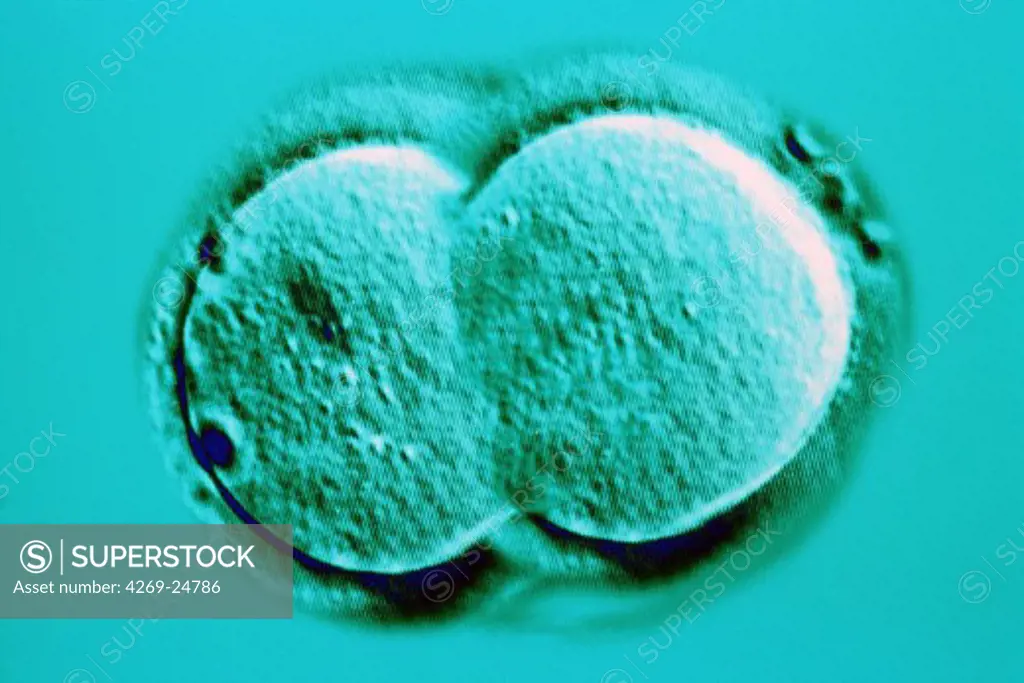 Cellular division. Optical micrograph of mitotic cell division. During mitosis, the nuclear material as well as cytoplasme and organelles of a cell divides to form to genetically identical cells.