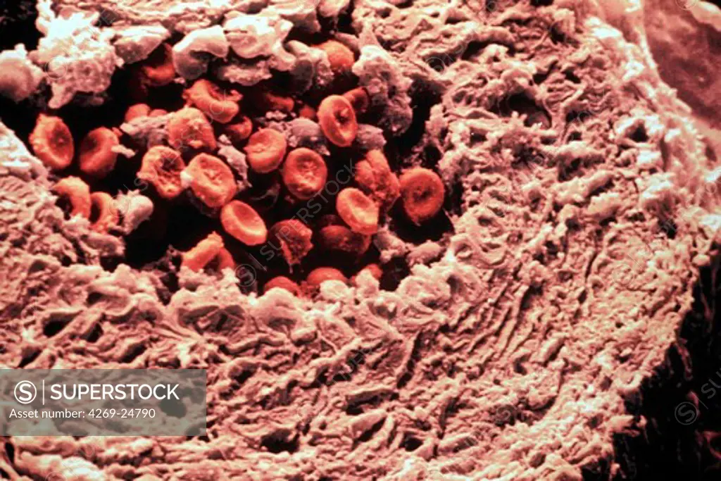 Collagen. Artery section Collagen fibres Myocytes;muscle cells Internal elastic layer ESM (Electron Scanning Microscope)
