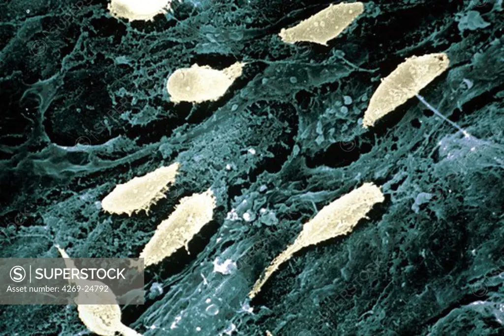 Collagen. Fibroplasts on external surface of intestine ESM (Electron Scanning Microscope)