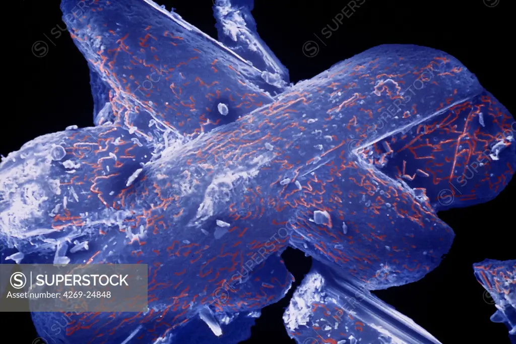Cristals of acetylsalicylic acid. SEM (Scanning Electron Microscope) of cristals of acetylsalicylic acid (aspirin).