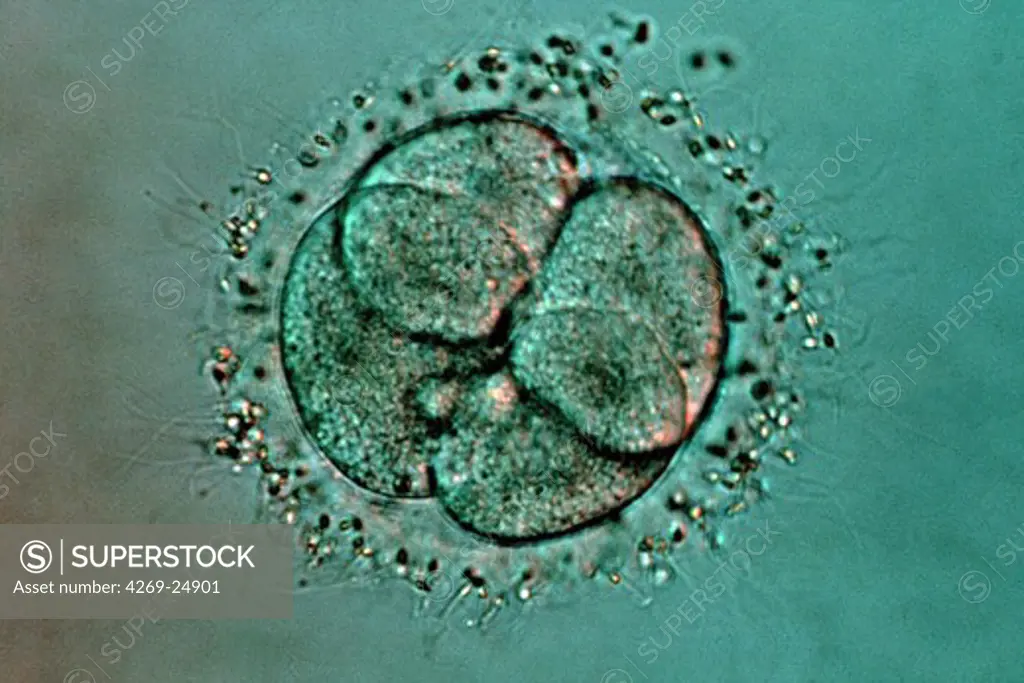 In Vitro Fertilization. IVF (In Vitro Fertilization) Cellular division : 4 cells stage Light microscope