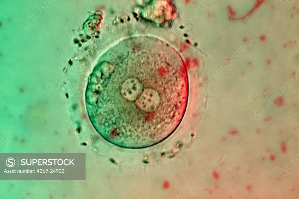 In Vitro Fertilization. IVF (In Vitro Fertilization) Cellular division 2 cells stage Light microscope